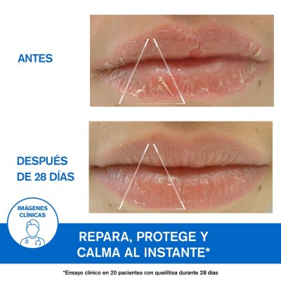 Bariederm Cica Labios 15 ml
