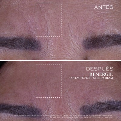 Rénergie Collage Lift Xtend 50 ml