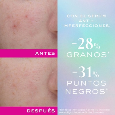 Zinc Power Sérum Anti-imperfecciones 30 ml